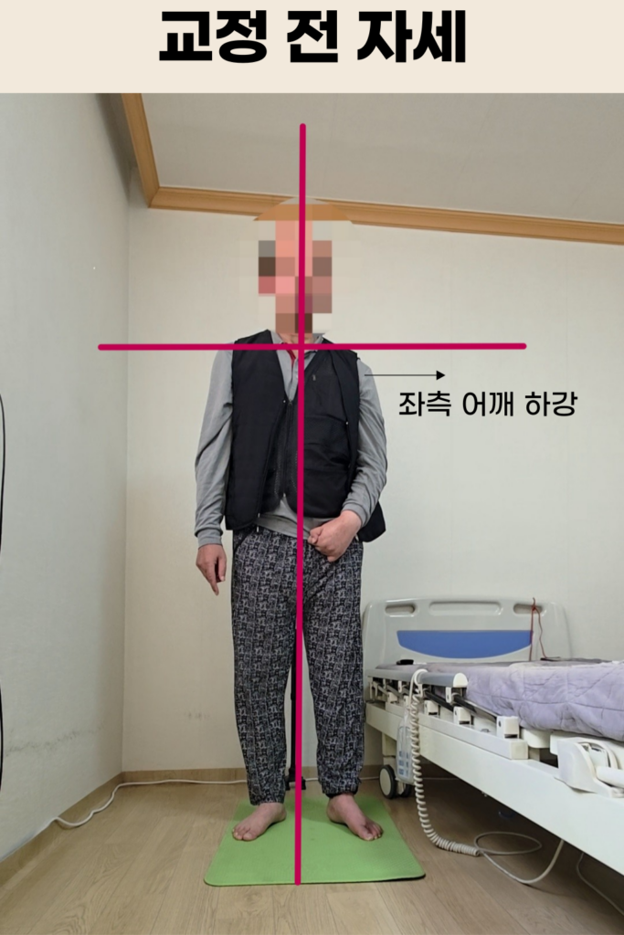 뇌혈관질환 재활 교정 장면