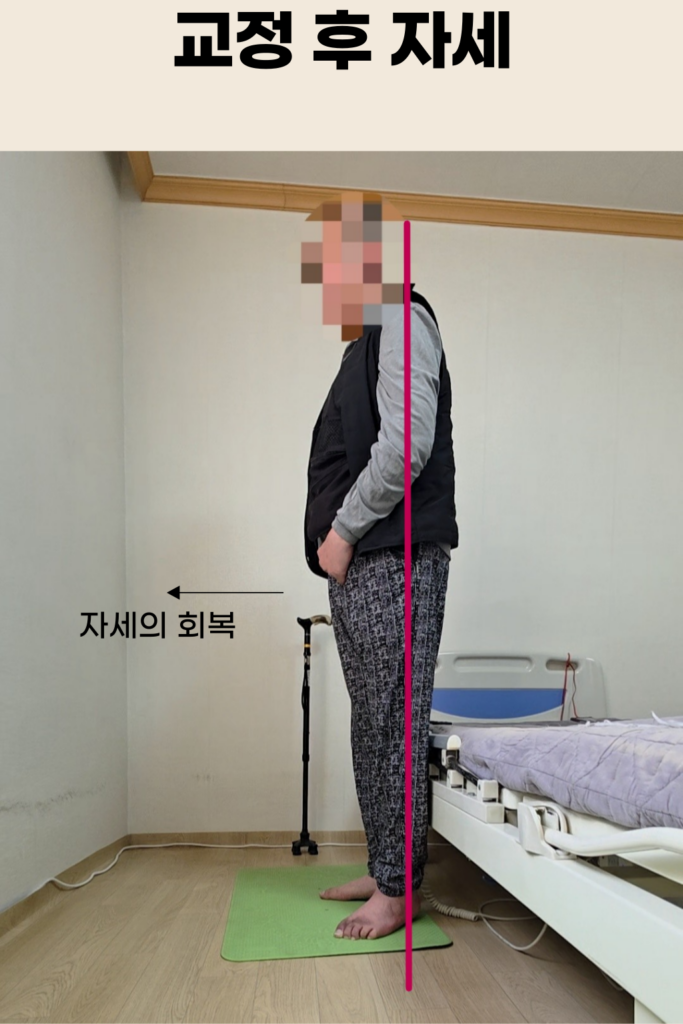 뇌혈관질환 재활 교정 장면